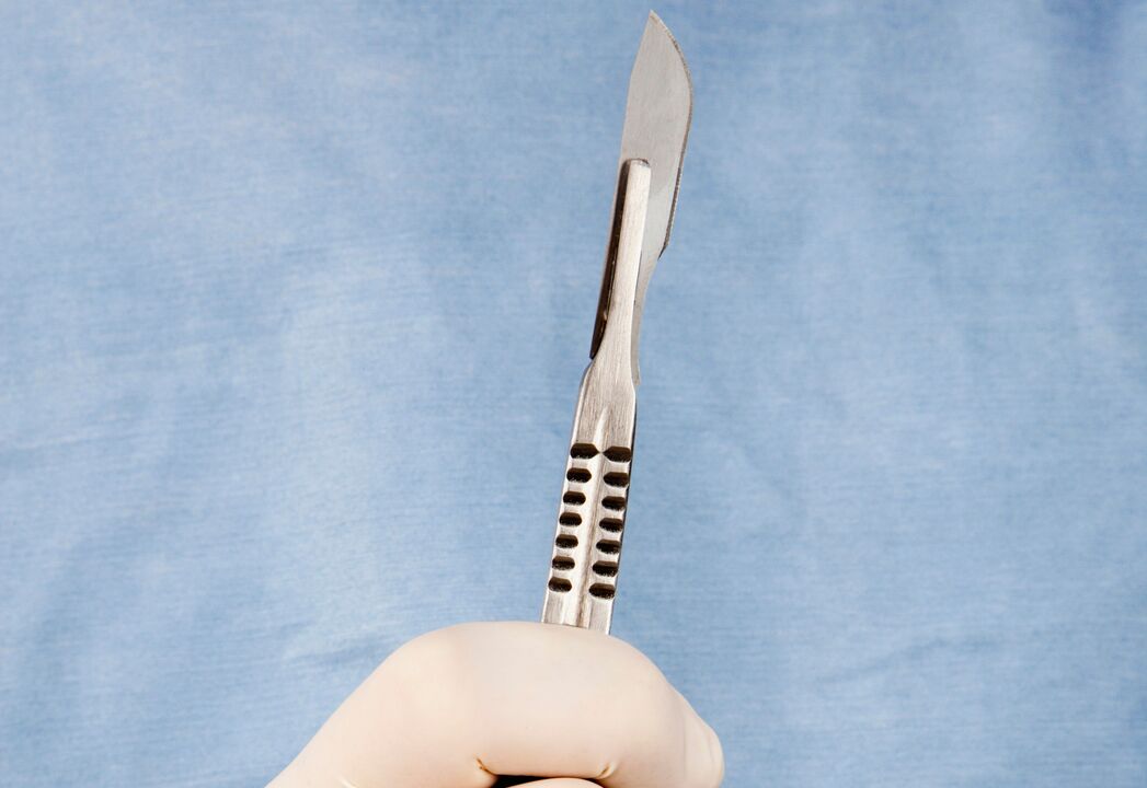 Scalpel voor penisvergrotingschirurgie